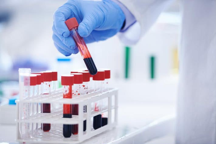 Gloved hand placing a blood sample tube in a rack